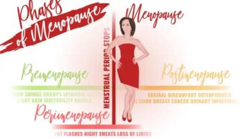 Stages of menopause.